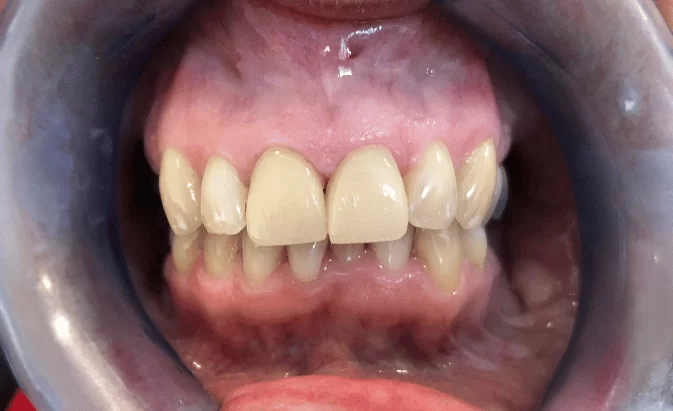 After - Lim Dental Practice