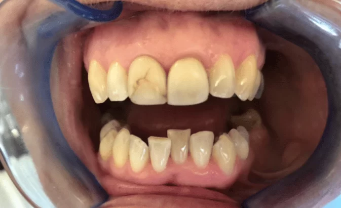 Before - Lim Dental Practice