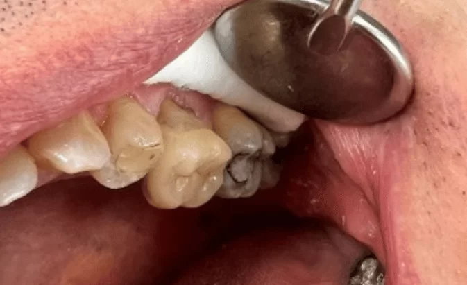 After - Lim Dental Practice