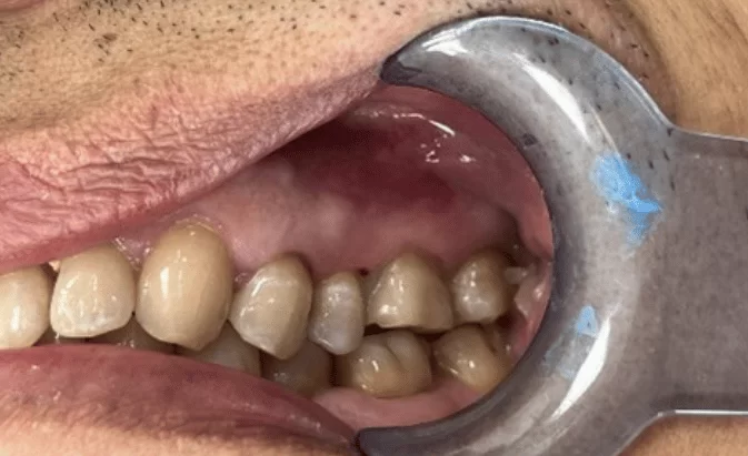 Before - Lim Dental Practice