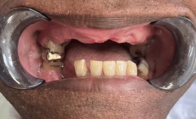 Before - Lim Dental Practice