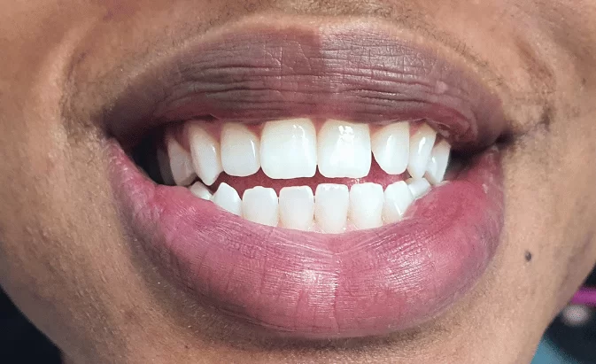 After - Lim Dental Practice