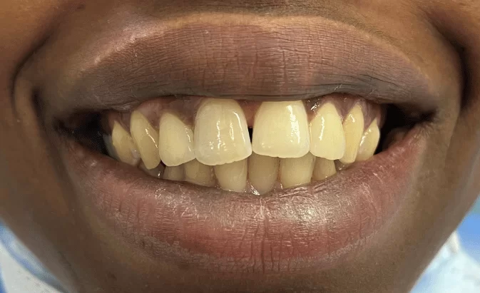 Before - Lim Dental Practice