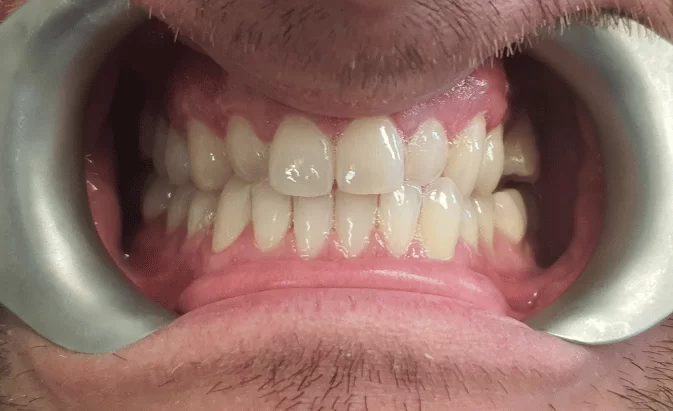 Before - Lim Dental Practice