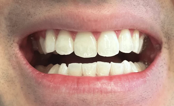 After - Lim Dental Practice