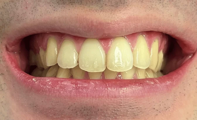 Before - Lim Dental Practice