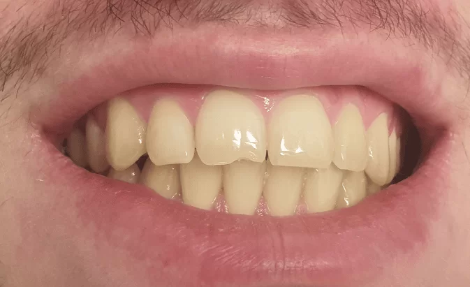 Before - Lim Dental Practice