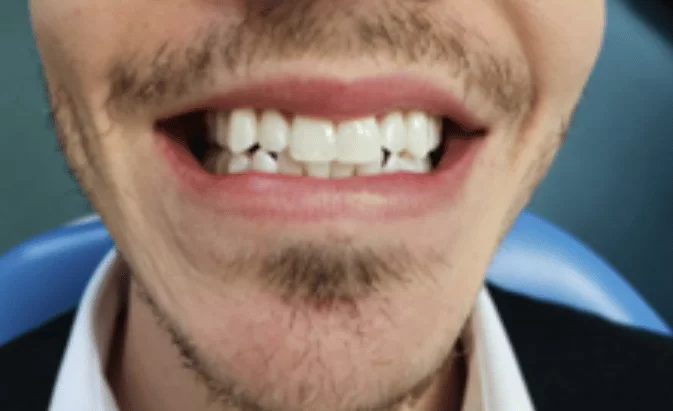 After - Lim Dental Practice