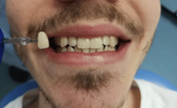 Before - Lim Dental Practice