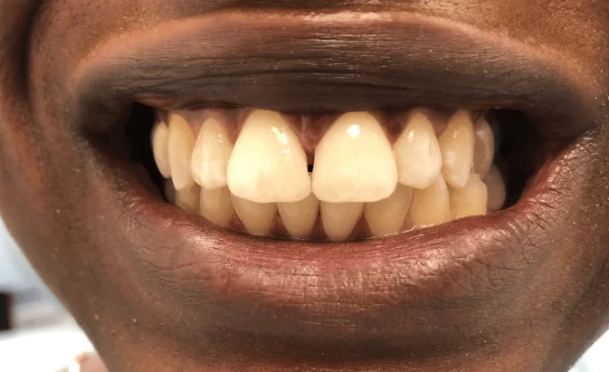 After - Lim Dental Practice