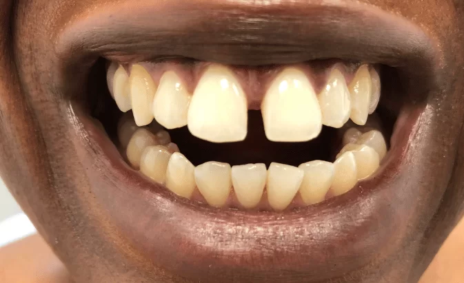 Before - Lim Dental Practice