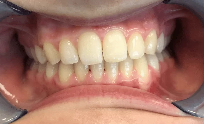 After - Lim Dental Practice