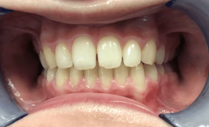 Before - Lim Dental Practice