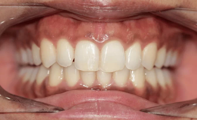 After - Lim Dental Practice