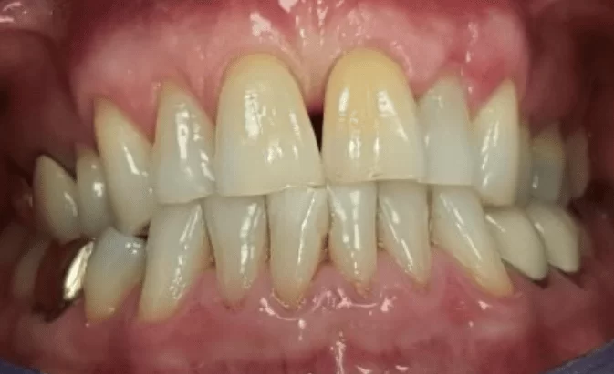 After - Lim Dental Practice