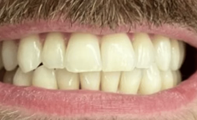 After - Lim Dental Practice