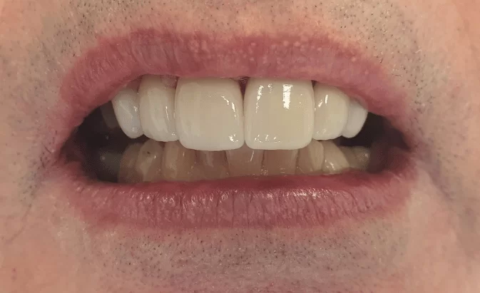 After - Lim Dental Practice